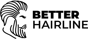 Better Hairline